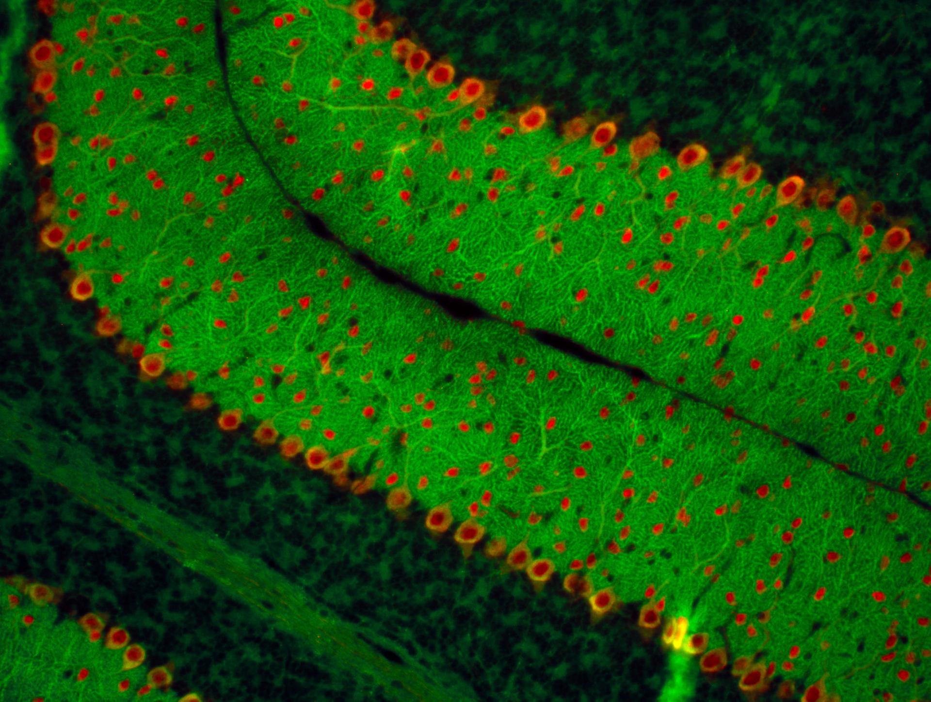 A fluorescent microscopy image shows a section of brain tissue from cerebellum, green indicating dendrite structures of Purkinje cells and red highlighting nuclei of inhibitory neurons. 