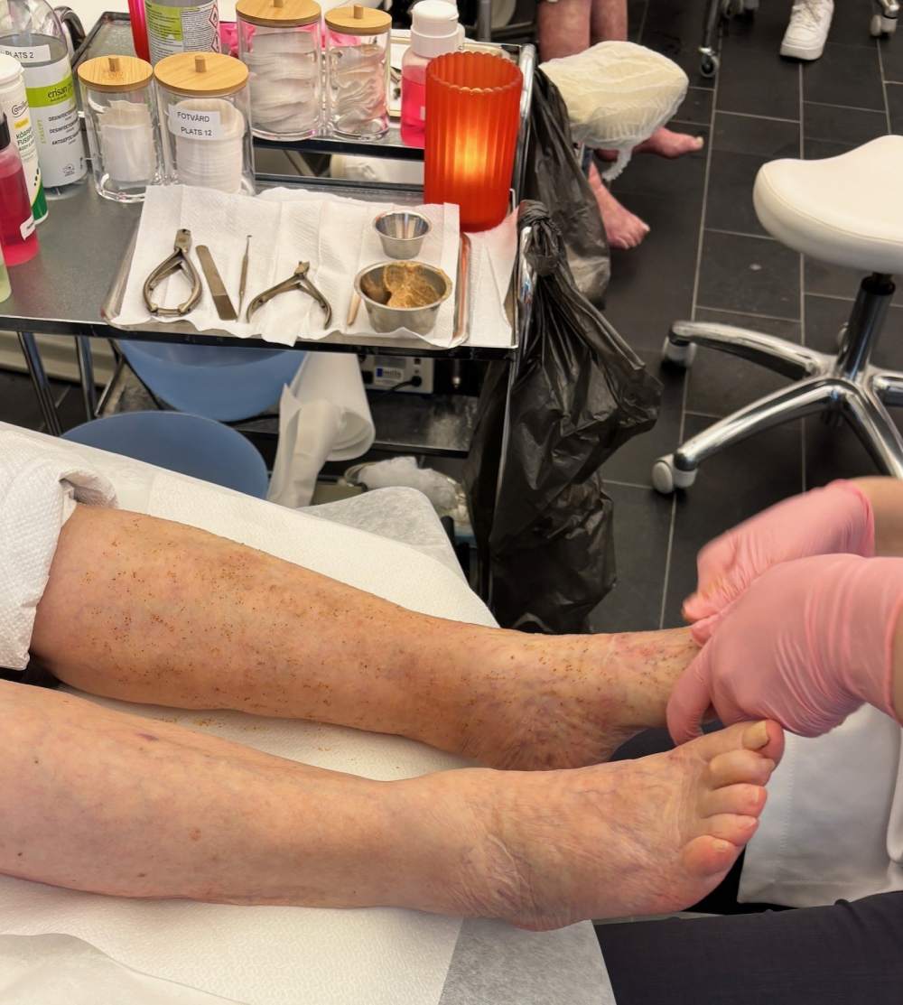 En äldre person får fotvård